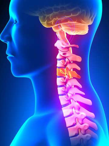 C4 Disc - Cervical Spine