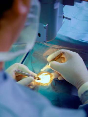 Corneal Transplant Surgery