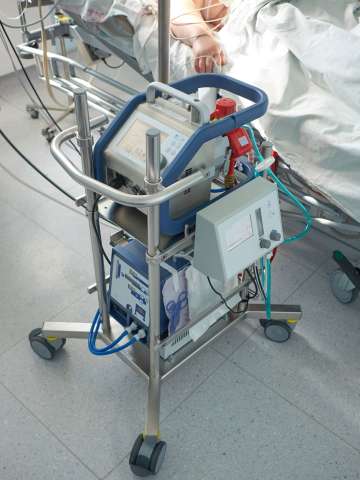 Extracorporeal membrane oxygenation. Working ECMO machine in intensive care department