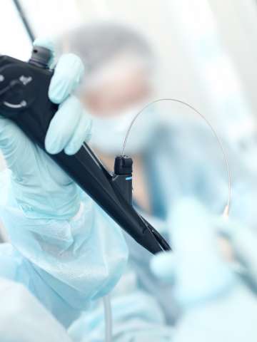 Interventional Endoscopy Illustration