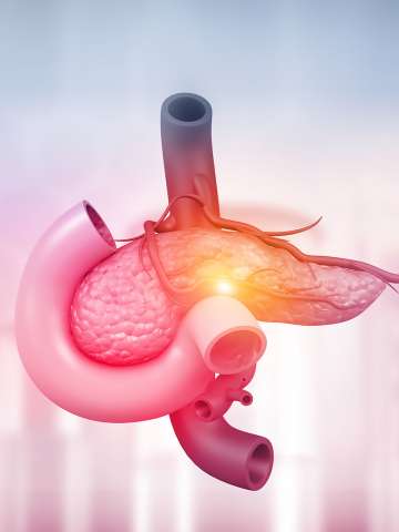 Pancreaticobiliary diseases