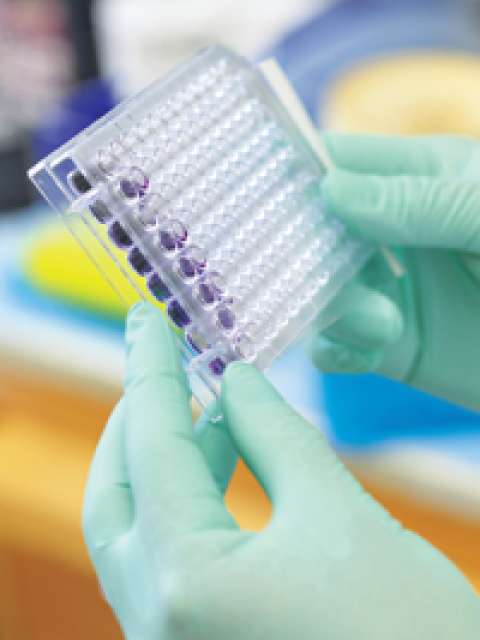 AIDS Research