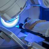 radiation therapy