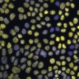 epithelial chromatin variation
