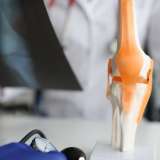 Knee joint with doctor holding x-ray.