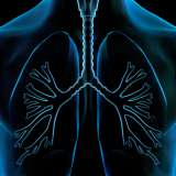 Lung Illustration, X-ray