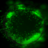 A microscopic image showing tumor cells integrating into the organoid.