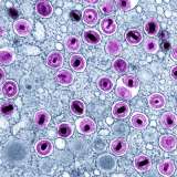 CMV particles