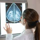 A doctor looks at a mammogram.