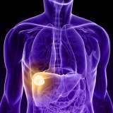 Liver Tumors