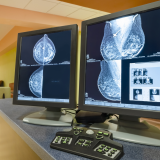 Breast scans on computer screens.