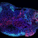 Microscopy image of a human stem cell-derived hippocampal organoid. 