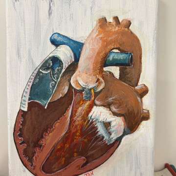 Dr. Jamil Aboulhosn's acrylic painting of the heart