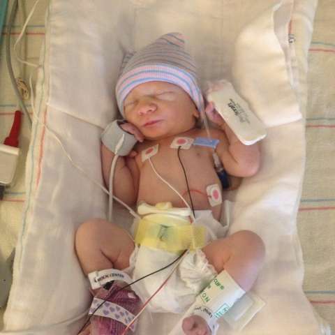 Newborn baby hooked up to monitors in the hospital